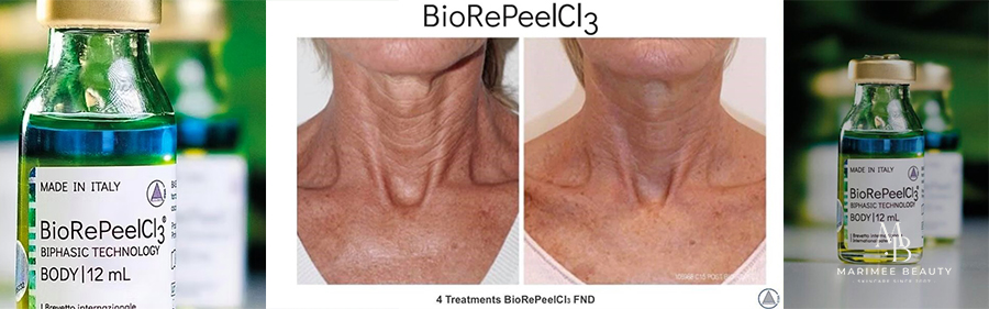 Biorepeel kehale.JPG (212 KB)